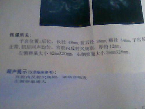 石河子药流没干净清宫多少钱