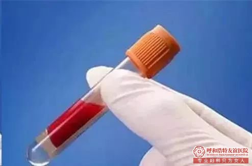石河子人流医院 早孕检查去哪家？